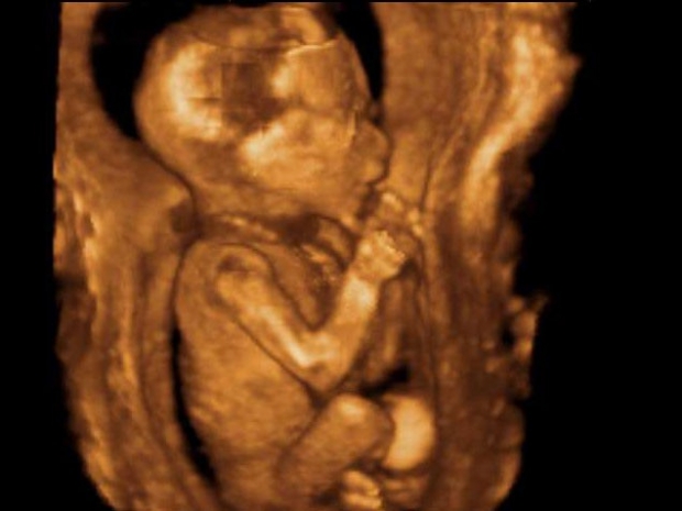 Фото 3D/4D УЗИ на 18 неделе беременности