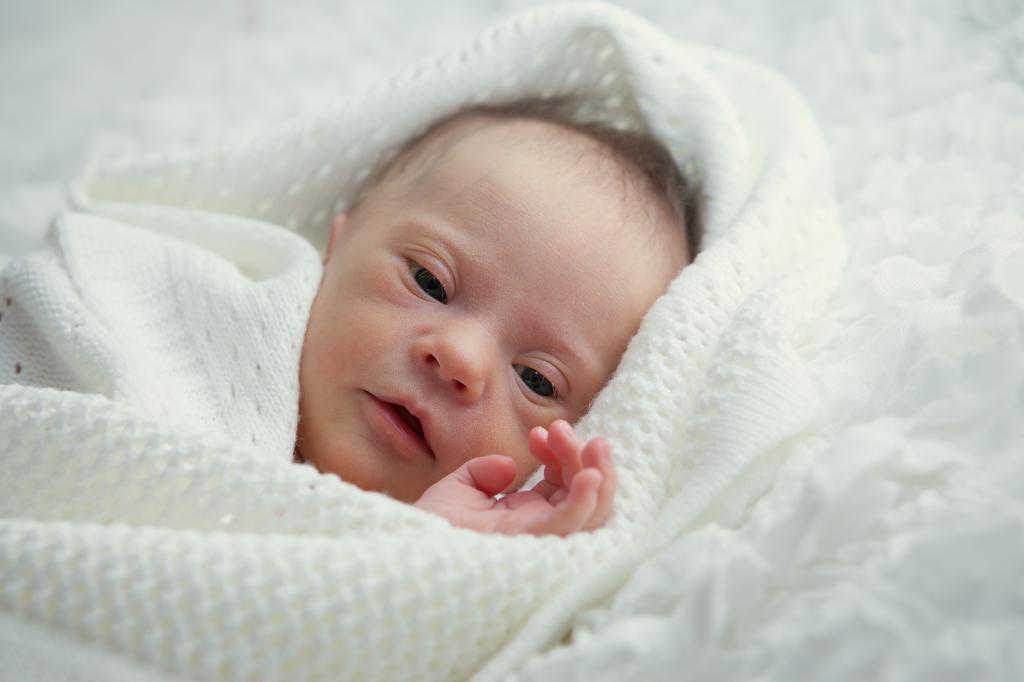Как выглядят новорожденные дети с синдромом Дауна