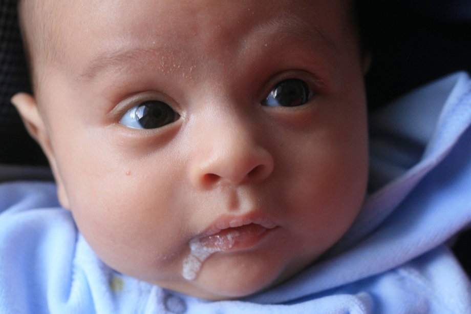 Почему ребенок часто срыгивает молоко?