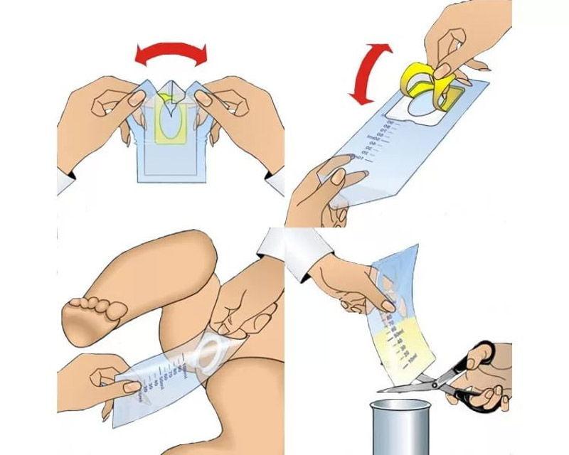 Как правильно использовать мочеприемник