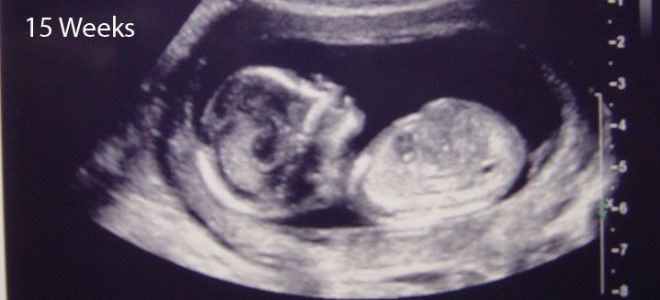 срок беременности 15 недель
