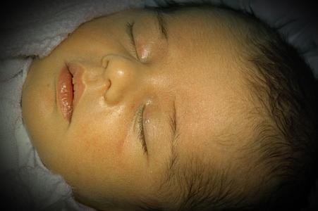 Желтуха новорожденных - причины, симптомы
